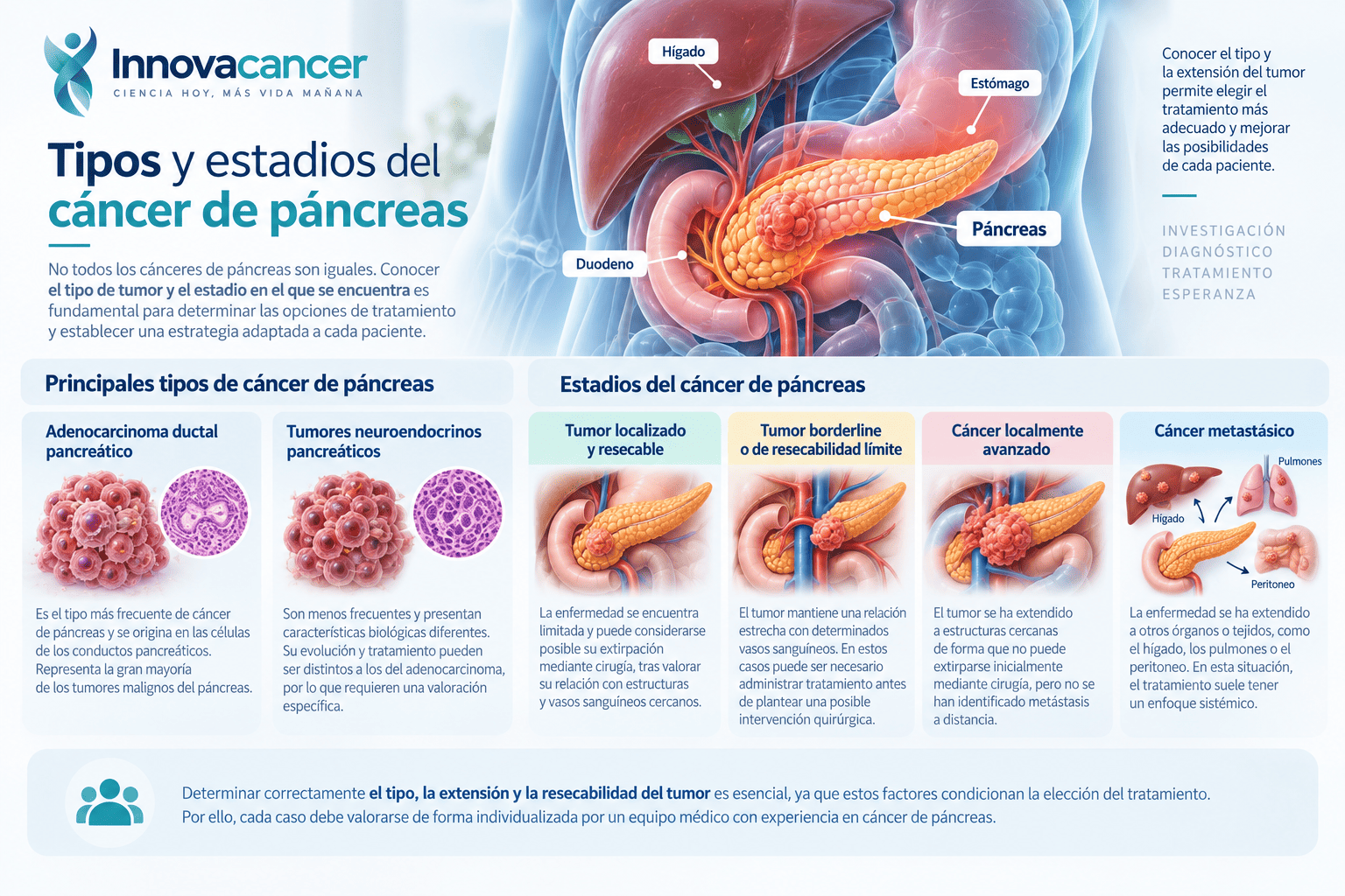 Tipos y estadios del cáncer de páncreas